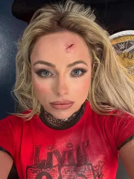 A close-up selfie of Liv Morgan with a cut on her forehead, wearing a red t-shirt.