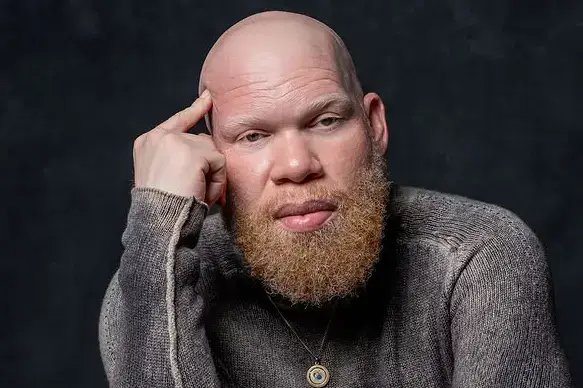 Krondon